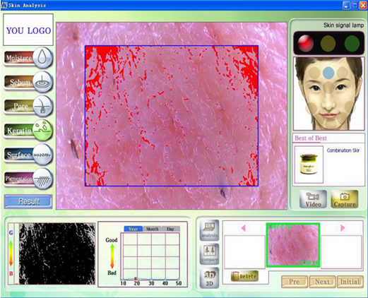 skin analyzer equipment touch machinetm107t hair Tingmay Brand skin scanner machine