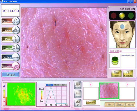 skin analyzer equipment touch machinetm107t hair Tingmay Brand skin scanner machine