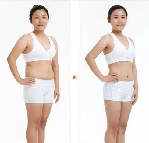 slimming best hifu machine cryolipolysis factory for adults-14