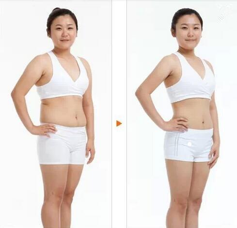 slimming best hifu machine cryolipolysis factory for adults