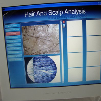 Tingmay instrument skin analysis machine for sale supplier for man-4