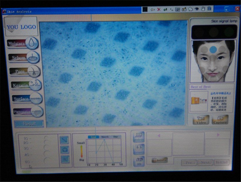 professional skin analysis machine for sale keyboard supplier for woman-8