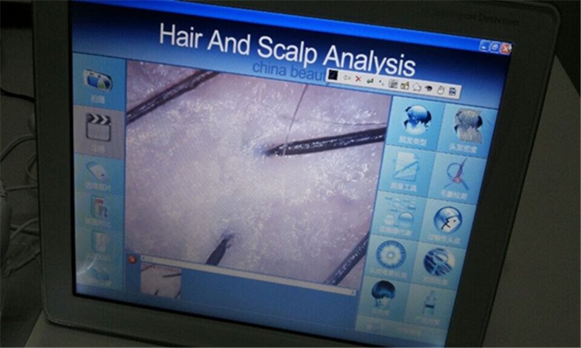 beauty skin analyzer machine touch screen design for man-4